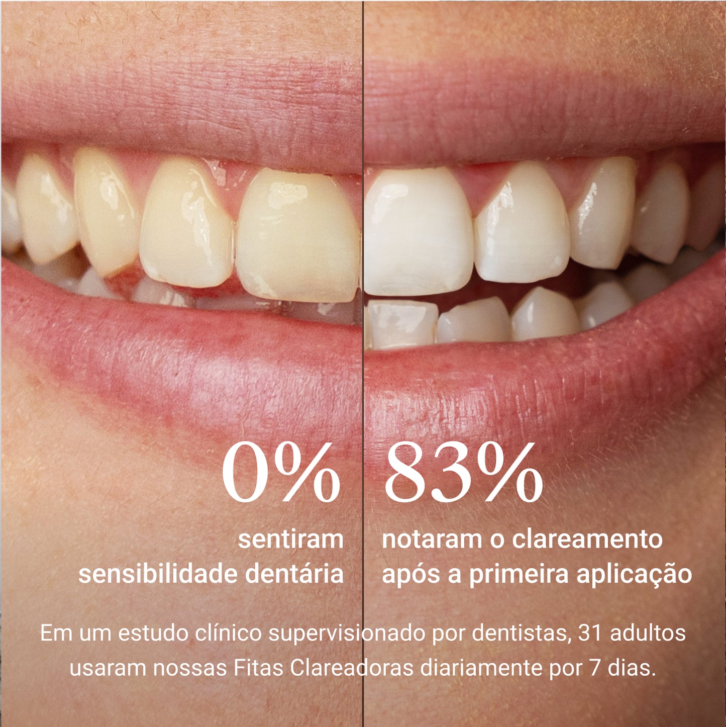 Fitas Clareadoras